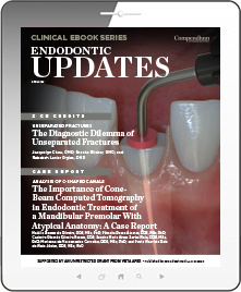 Endodontic Updates Ebook Cover