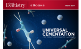 What challenges do universal cementation present?