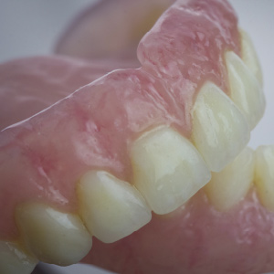 The Preferred 3D Printed Denture Solution Ebook Library Image