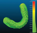 Fig 17. The 3D printed dentures are scanned into CAD software to assess the fidelity to the digital design file. Red is least accurate and green is most accurate. Clearly, the polyjet 3D printing process produced extremely high dimensional accuracy.