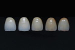 Figure 24  Simulation of the aging process of dentition.