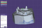 Fig 12. The block-out layer was set to 0.25 mm and 0-degree undercut. This
will allow the printed “taco shell” denture to be precisely repositioned over the metal bar.