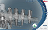 Figure 21  (Case 2) Final implant restoration with adjacent crowns following surgical crown lengthening.