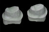 Figure 10  The laboratory may choose to add more contour to the lingual surface of the maxillary anteriors.