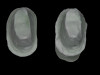 Figure 11  Combination of addition of maxillary lingual contour and mandibular incisal length.
