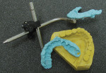 Figure 1  Properly articulated models will be set on a Bonwill-friendly semi-adjustable articulator using a facebow.