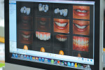 Figure 4  To address the patient’s desire to close the diastema between teeth Nos. 8 and 9, the author shared images on his desktop to discuss issues of tooth width-to-height ratio.