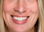 Figure 19  After conservative cosmetic dentistry, the patient’s concerns were met and her expectations were fulfilled.