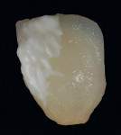 Figure 19  Additional corrective porcelain powder and Creation ZI-F powder were applied to the restoration.