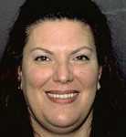 Figure 15  Posttreatment photograph of the patient’s full smile.