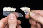 Figure 6  A setup of the posterior teeth using the Q³ Pack available in an innovative wax-free pack.