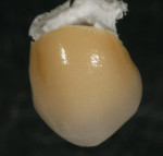 Figure 37  Buccal view of the glazed crown.