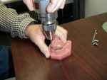 Figure 3  Using a torque gauge to measure abutment removal.
