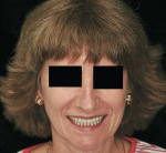Figure 9  Posttreatment smile of the same patient.