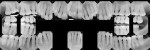 Figure 1  Complete radiographic series.