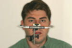 Figure 4  Face-bow on patient with facial discrepancies. The level on the bow helps align maxilla with bench top.