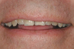 Figure 23  This view shows the natural smile of a patient seeking smile enhancement dentistry.