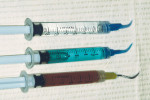 Figure 3  Use a syringe with over-the-counter (OTC) peroxide, 2% chlorhexidine gluconate, or ferric sulphate solution to scrub. Note the tips.