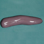 Figure 10   Example of one scoop of putty hot dog.