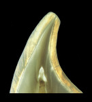 Figure 1A  These tooth sections depict the varying thicknesses of the enamel according tothe shape of the tooth and its location on the crown (Figure 1A courtesy of Dr. Stephan J. Paul; Figure 1Bcourtesy of Dr. Didier Dietschi).