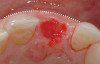 (6.) Preoperative right lateral, open view.