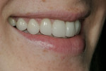 Figure 15  Alternate postoperative image of the patient’s smile.