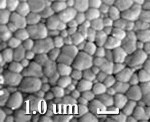 Figure 1  A scanning electron microscope (SEM) (1.0 µm) shows the density of sintered zirconia.