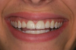 Figure 7  Case 3 pre-treatment photograph of patient’s smile.