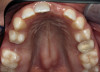 Fig 2. Preventive care for periodontitis should be based on the patient’s past history of disease and risk factors.