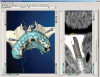 Fig 8. The CBCT scan and the scan from the cast are overlapped to plan the surgery.