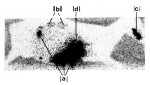 Figure 2. Autoradiogram of sheep after teeth were removed, in experiment showing in-vivo distribution of mercury from amalgam fillings.