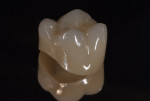 Figure 24 Lava Plus monolithic translucent zirconia crown differentially colored with incisal and dentin internally then polished with Dialite ZR system.