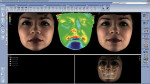 Figure 1  With CBVT technology, volume ranges can be produced to view a single tooth or whole skull region. Lasers scan the face while a digital camera captures the facial images. Soft-tissue images can be overlaid on top of the cone beam images, ena