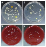 Figure 1. Representative images of aerobic bacterial colonies on Trypticase soy agar plates (A, B) and of anaerobic bacterial colonies grown on 5% sheep blood agar plates (C, D) from post-treatment bib clips at the hygiene clinic.
