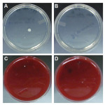 Figure 2. Representative images of aerobic bacterial colonies on Trypticase soy agar plates (A, B) and of anaerobic bacterial colonies grown on 5% sheep blood agar plates (C, D) from post-disinfection bib clips at the hygiene clinic.