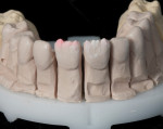 Dentine and transitional dentine powders were used to mimic typical internal dentine structures of teeth.