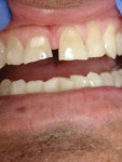 Figure 1 Patients can experience transforming their smile in one visit.