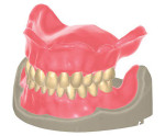 Sample denture CAD model from Exocad’s upcoming Denture Design Module.