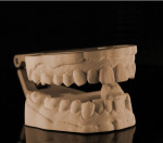 Digitally printed model from a Trios intraoral scan made on a Projet MP 3510.