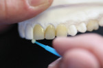 Figure 17 With a microbrush, white incisal highlights are placed, which also increases the perception of incisal translucency.