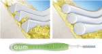 Figure 8  Novel triangular shaped bristle filaments (left) for increased plaque removal effectiveness in interproximal cleaning (versus conventional round filaments shown on right).