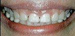 Figure 14  The patient’s smile before treatment.