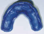 Figure 2  The custom tray for implant impression.