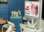 Figure 4  The Cadent unit in use.