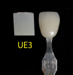 Figure 5 A close match between the UE3 enamel shade and the VITA Classical Shade Guide shade B1.