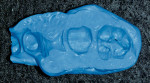 Figure 9   Occlusal view of the bite record. Note that the small perforations in the cuspal areas verify complete centric closure.