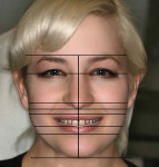 Figure 4 The facial evaluation.
