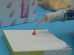 Figure 4. Extruding a pink glass-ionomer cement to be used as a temporary filling material.