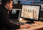Justin Hayes uses 3Shape CAD software for crown design.