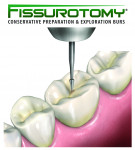 SS White Dental's Fissurotomy Bur